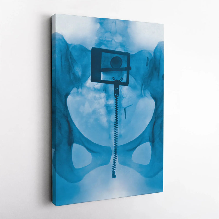 Pelvis X-Ray Art Canvas | Surreal Medical Anatomy Print | Premium Gallery Wrap Decor | Unique Physician Gift for Doctors & Medical Professionals
