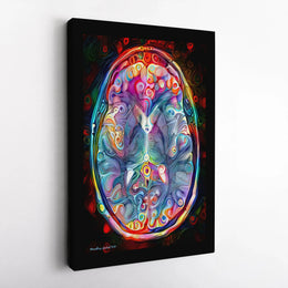 Human Brain Canvas Wall Art | Psychedelic Neuroscience Anatomy Poster | Premium Gallery Wrap Decor | Gift for Medical Students and Neurologists