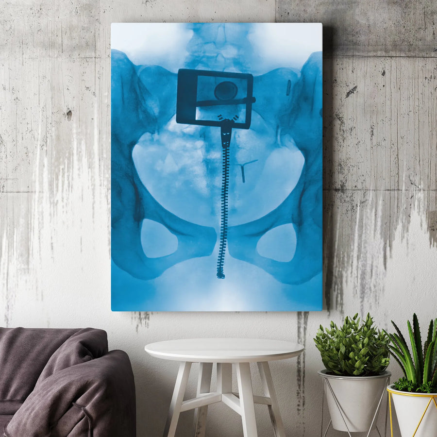 Pelvis X-Ray Art Canvas | Surreal Medical Anatomy Print | Premium Gallery Wrap Decor | Unique Physician Gift for Doctors & Medical Professionals